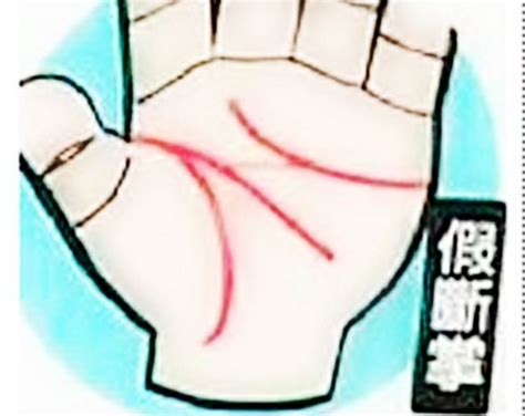 双手假断掌的男人的命运_两手假断掌的男人的命运,第3张 双手假断掌的男人的命运_两手假断掌的男人的命运,第3张