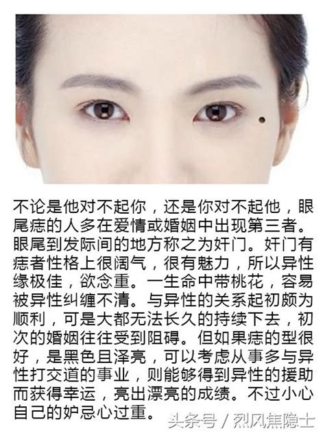 脸部痣图解女性_脸部痣图解女性面相,第12张 脸部痣图解女性_脸部痣图解女性面相,第12张