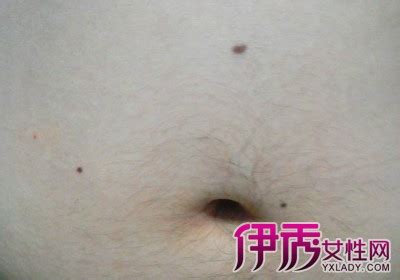 肚脐下面长痣好不好_肚脐下面长痣是什么意思,第3张 肚脐下面长痣好不好_肚脐下面长痣是什么意思,第3张