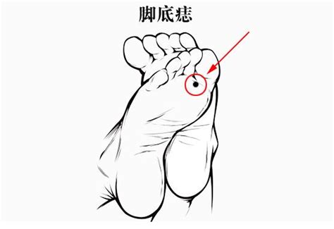 帝王痣的位置图_帝王痣的位置图解,第3张 帝王痣的位置图_帝王痣的位置图解,第3张
