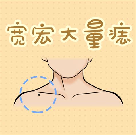 新生儿怎么辨别是不是胎记_怎么判断婴儿是不是胎记,第16张 新生儿怎么辨别是不是胎记_怎么判断婴儿是不是胎记,第16张