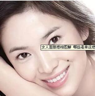 女人脸上痣的位置代表什么_女人脸上痣的位置与命运图解,第3张 女人脸上痣的位置代表什么_女人脸上痣的位置与命运图解,第3张