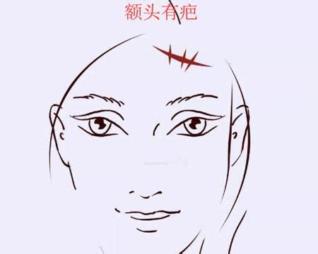 尖嘴猴腮的男人面相_尖嘴猴腮长什么样,第3张