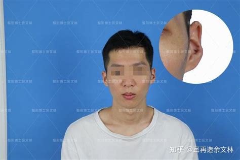 反骨面相_反骨面相是什么意思,第3张