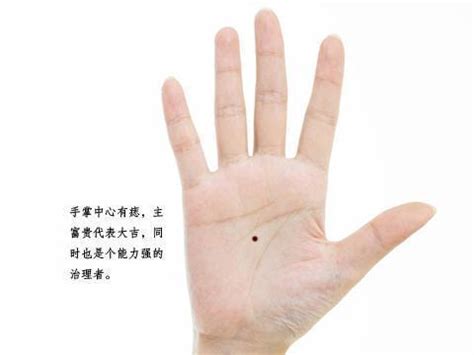 女人右手掌心有痣代表什么意思_女人左手掌心有痣是什么寓意,第10张 女人右手掌心有痣代表什么意思_女人左手掌心有痣是什么寓意,第10张
