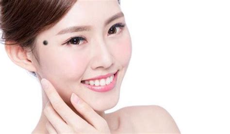 女人脸上痣的位置代表什么_女人脸上痣的位置与命运图解,第4张 女人脸上痣的位置代表什么_女人脸上痣的位置与命运图解,第4张