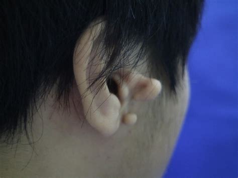 男人耳朵形状与命运图解_耳朵形状与命运图解耳轮突出,第12张