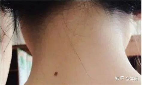 腰上长痣的女人命运如何_腰上长痣的女人命好吗,第4张 腰上长痣的女人命运如何_腰上长痣的女人命好吗,第4张