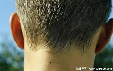 男人10处有痣是富贵痣_男人10处有痣是富贵痣图解,第4张 男人10处有痣是富贵痣_男人10处有痣是富贵痣图解,第4张