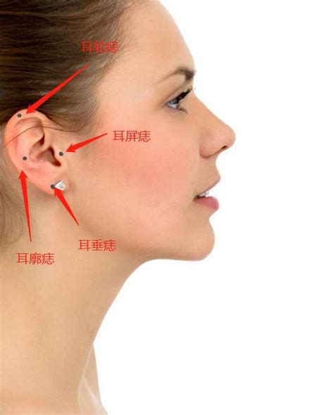 耳朵长痣的位置代表什么_耳朵长痣的位置代表什么意思,第4张