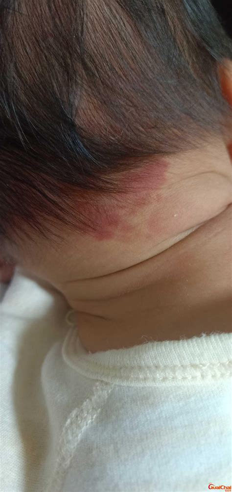 脖子上有胎记代表什么意思_脖子上有胎记有啥寓意,第8张 脖子上有胎记代表什么意思_脖子上有胎记有啥寓意,第8张