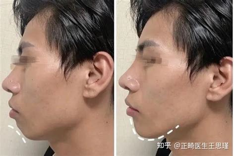 最有福气的下巴图片女人_最有福气的下巴图片男,第10张 最有福气的下巴图片女人_最有福气的下巴图片男,第10张