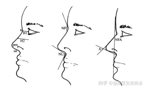 通天鼻子的男人命运好不好_通天鼻子的男人是什么命,第13张