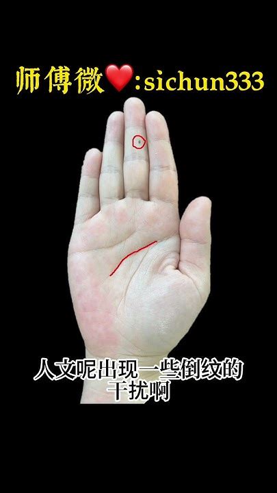 左手食指有痣的女人配偶_左手食指有痣的女人配偶如何,第7张 左手食指有痣的女人配偶_左手食指有痣的女人配偶如何,第7张