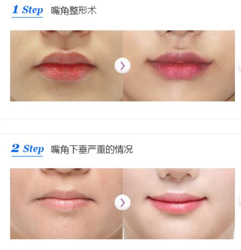 唇珠在面相中代表什么_唇珠明显的女人面相,第20张