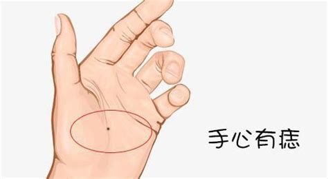 女人少见的极富贵痣手_女人少见的极富贵痣掌心痣,第6张 女人少见的极富贵痣手_女人少见的极富贵痣掌心痣,第6张