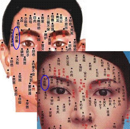 男人10处有痣是富贵痣_男人10处有痣是富贵痣图解,第5张