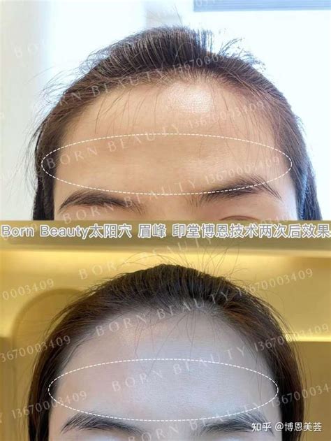 印堂凹陷有什么不好_男人印堂凹陷有什么不好,第11张 印堂凹陷有什么不好_男人印堂凹陷有什么不好,第11张