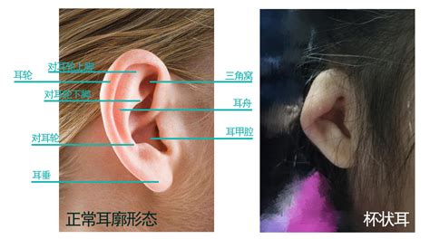 三种有福招财的耳朵是什么样子的_三种有福招财的耳朵,第5张