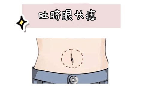 肚脐下面长痣好不好_肚脐下面长痣是什么意思,第5张 肚脐下面长痣好不好_肚脐下面长痣是什么意思,第5张
