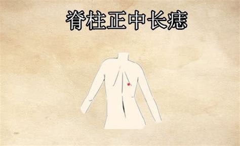 背上长痣好不好_背上长痣有什么寓意,第13张 背上长痣好不好_背上长痣有什么寓意,第13张