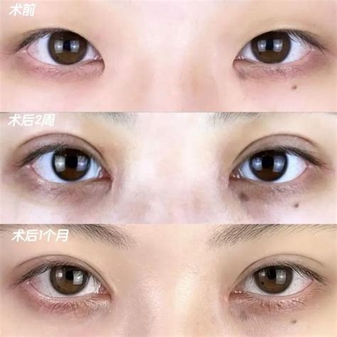 双眼皮的女人桃花运好吗_双眼皮的女人桃花运怎么样,第5张 双眼皮的女人桃花运好吗_双眼皮的女人桃花运怎么样,第5张