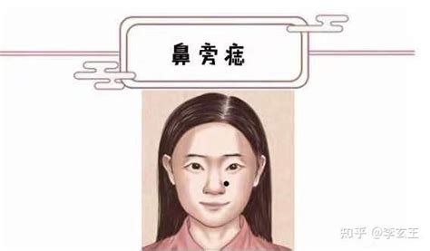 脸部痣图解女性_脸部痣图解女性面相,第14张 脸部痣图解女性_脸部痣图解女性面相,第14张
