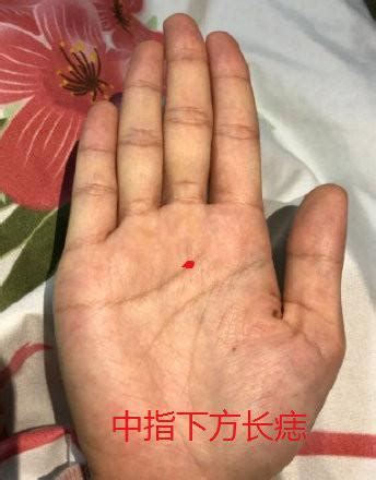 婚姻线附近有颗痣代表什么_婚姻线上面有颗痣是什么意思,第14张 婚姻线附近有颗痣代表什么_婚姻线上面有颗痣是什么意思,第14张