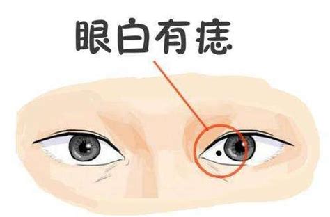 桃花痣长在哪里_女人的桃花痣长在哪里,第6张 桃花痣长在哪里_女人的桃花痣长在哪里,第6张