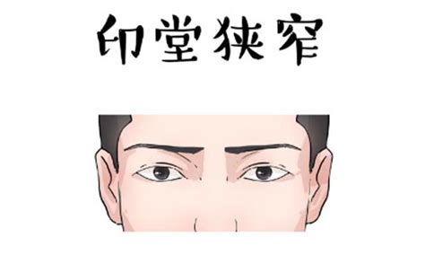 印堂凹陷有什么不好_男人印堂凹陷有什么不好,第12张 印堂凹陷有什么不好_男人印堂凹陷有什么不好,第12张