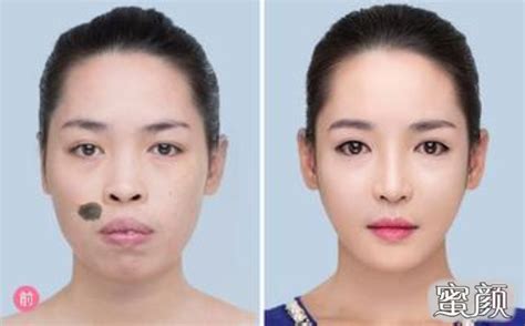 痦子位置解说图_痦子位置解说图女生,第11张 痦子位置解说图_痦子位置解说图女生,第11张
