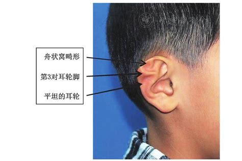 阳寿已尽的面相及颜色分析_如何看一个人阳寿已尽寿,第14张