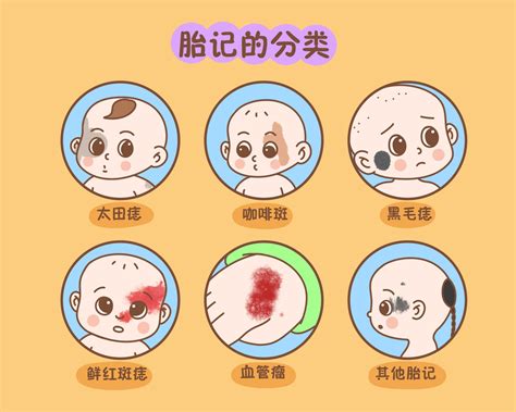 后背上有胎记的女人命运好不好_后背上有胎记的女人命运如何,第6张 后背上有胎记的女人命运好不好_后背上有胎记的女人命运如何,第6张
