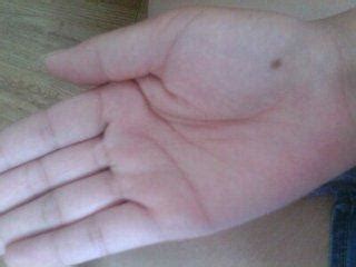 女人少见的极富贵痣手_女人少见的极富贵痣掌心痣,第8张 女人少见的极富贵痣手_女人少见的极富贵痣掌心痣,第8张