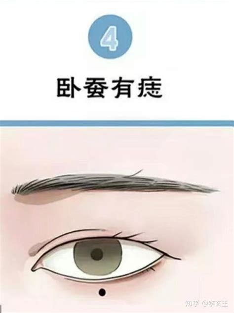 痦子位置解说图_痦子位置解说图女生,第12张 痦子位置解说图_痦子位置解说图女生,第12张