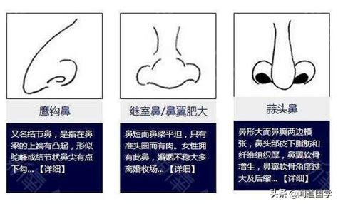 鼻子大的男人说明什么_鼻子大的男人面相好不好,第16张