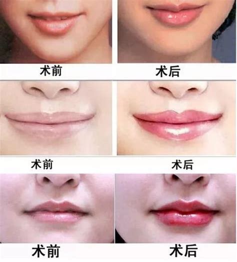 唇珠在面相中代表什么_唇珠明显的女人面相,第8张 唇珠在面相中代表什么_唇珠明显的女人面相,第8张