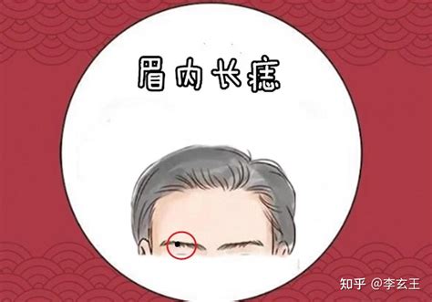 脸部痣图解女性_脸部痣图解女性面相,第8张 脸部痣图解女性_脸部痣图解女性面相,第8张