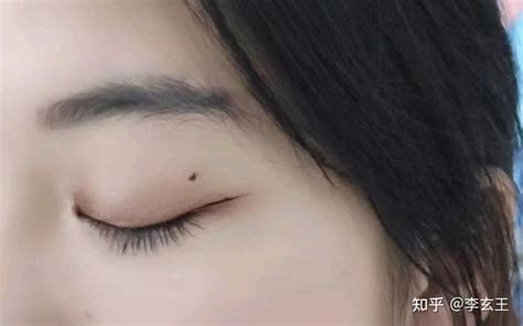 痦子位置解说图_痦子位置解说图女生,第13张 痦子位置解说图_痦子位置解说图女生,第13张