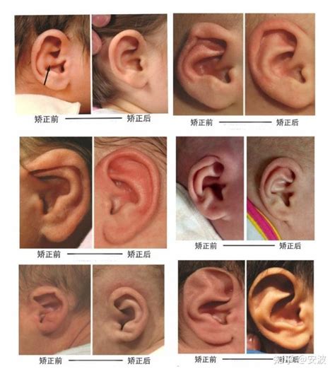 耳朵形状与命运图解猫耳_耳朵形状与命运图解龙耳,第14张