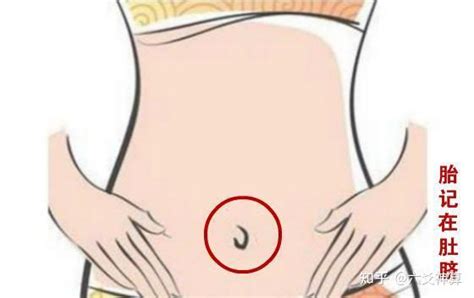 新生儿怎么辨别是不是胎记_怎么判断婴儿是不是胎记,第21张 新生儿怎么辨别是不是胎记_怎么判断婴儿是不是胎记,第21张