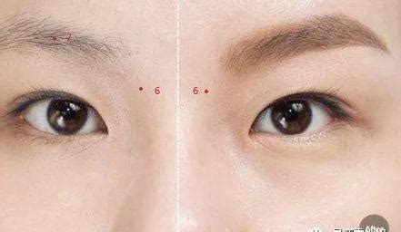 男人10处有痣是富贵痣_男人10处有痣是富贵痣图解,第9张 男人10处有痣是富贵痣_男人10处有痣是富贵痣图解,第9张