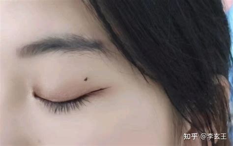 脸部痣图解女性_脸部痣图解女性面相,第9张 脸部痣图解女性_脸部痣图解女性面相,第9张