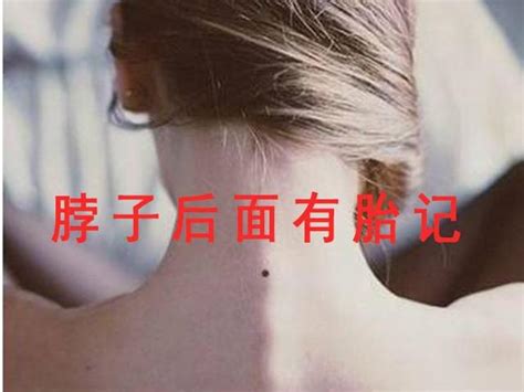 大腿上有胎记代表什么_大腿上有胎记好不好,第16张 大腿上有胎记代表什么_大腿上有胎记好不好,第16张
