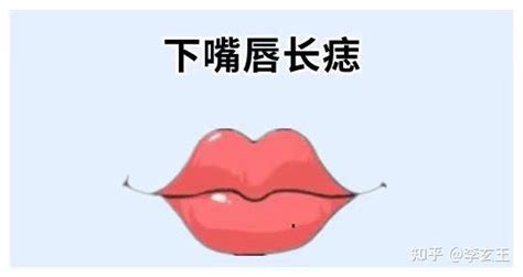 脸部痣图解女性_脸部痣图解女性面相,第19张 脸部痣图解女性_脸部痣图解女性面相,第19张