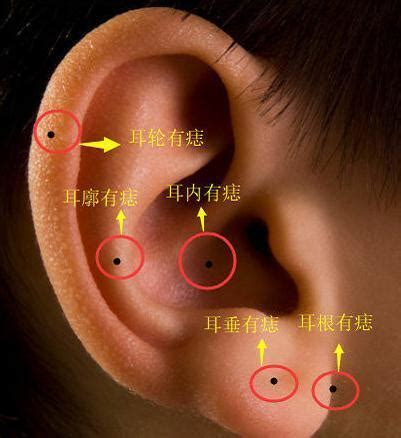 耳朵上长痣好吗图解_耳朵上长痣好吗哪个位置长痣不好,第10张