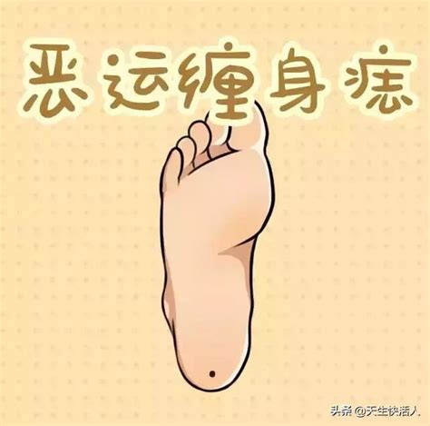 新生儿怎么辨别是不是胎记_怎么判断婴儿是不是胎记,第23张 新生儿怎么辨别是不是胎记_怎么判断婴儿是不是胎记,第23张