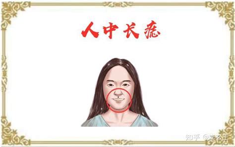 女人脸上长痣图片_女人脸上长痣图片面相,第21张