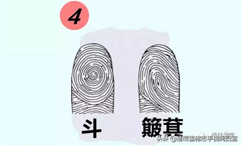 女人手指斗簸箕看命运_手指斗簸箕看命运准吗,第10张 女人手指斗簸箕看命运_手指斗簸箕看命运准吗,第10张