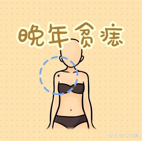 新生儿怎么辨别是不是胎记_怎么判断婴儿是不是胎记,第24张 新生儿怎么辨别是不是胎记_怎么判断婴儿是不是胎记,第24张